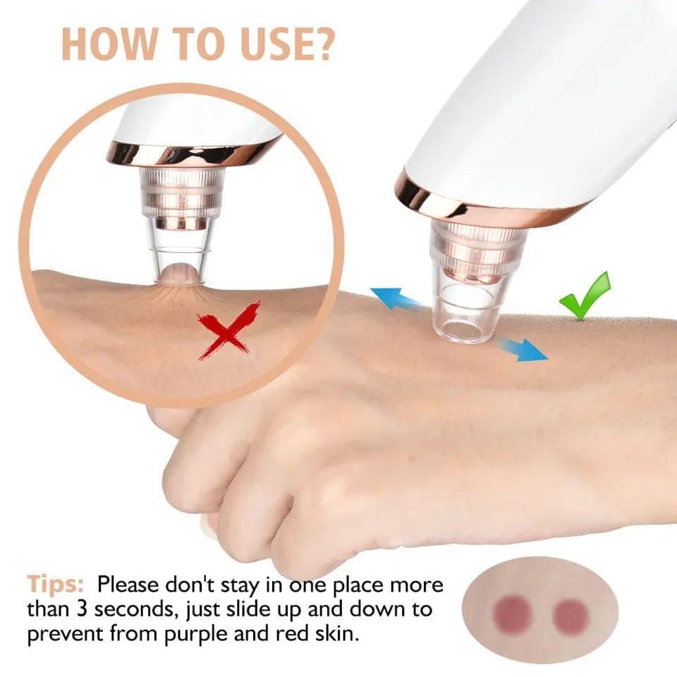 Battery Operated Black Head Remove